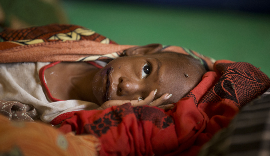 Hungersnöden riskerar att bli ännu värre i Sahelområdet, där länder som Tchad, Mali, Senegal och Burkina Faso är belägna.