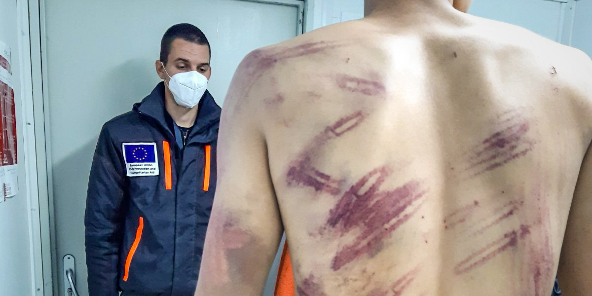 Migrant som säger sig blivit misshandlad och tillbakavisad till Bosnien av kroatiska poliser när de försökte ta sig in i Kroatien.