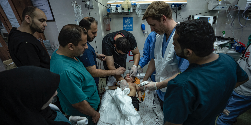 Ett palestinskt barn som har skadats i en israelisk attack behandlas av läkare på ett sjukhus i Khan Younis i södra Gazaremsan.